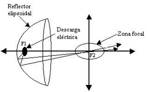 Se enfocan ondas desde una
camara semielipsoidal hacia
la piedra para su pulverización.