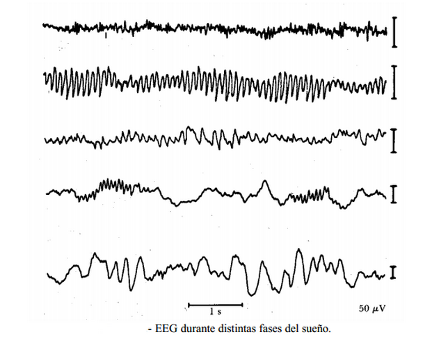 Electroencefalografo - Apuntes De Electromedicina Xavier Pardell